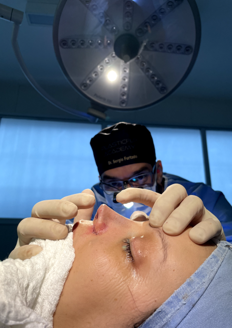 Rinoplastia - Rinoplastia